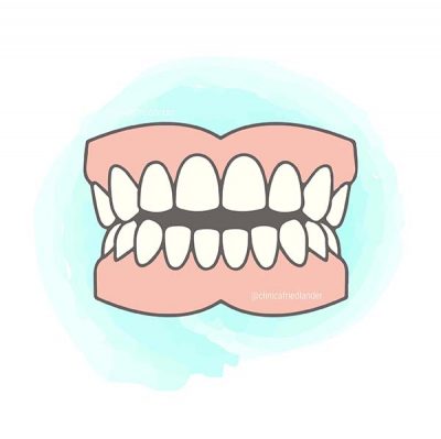 mordida-abierta-ortodoncia