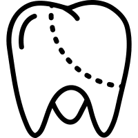 sellado-endodoncia-vera